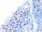 Arp3 Antibody in Immunohistochemistry (Paraffin) (IHC (P))