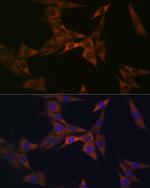 BMP6 Antibody in Immunocytochemistry (ICC/IF)