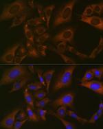 BMP6 Antibody in Immunocytochemistry (ICC/IF)