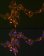 ACADM Antibody in Immunocytochemistry (ICC/IF)