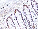 ACADM Antibody in Immunohistochemistry (Paraffin) (IHC (P))