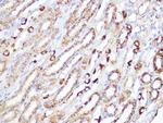 ACADM Antibody in Immunohistochemistry (Paraffin) (IHC (P))