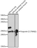 TNNI2 Antibody in Western Blot (WB)