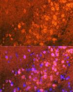 JNK1/JNK2/JNK3 Antibody in Immunohistochemistry (Paraffin) (IHC (P))