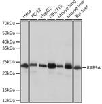 RAB9 Antibody in Western Blot (WB)