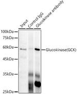 GCK Antibody in Immunoprecipitation (IP)