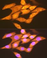 FGF1 Antibody in Immunocytochemistry (ICC/IF)