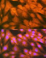 FGF1 Antibody in Immunocytochemistry (ICC/IF)