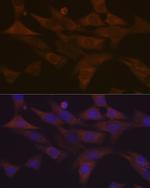 PKC delta Antibody in Immunocytochemistry (ICC/IF)