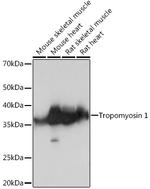 TPM1 Antibody in Western Blot (WB)