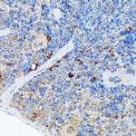 CARD11 Antibody in Immunohistochemistry (Paraffin) (IHC (P))