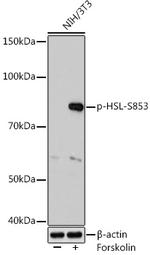 Phospho-HSL (Ser853) Antibody in Western Blot (WB)