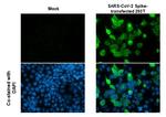 SARS/SARS-CoV-2 Spike Protein S2 Antibody in Immunocytochemistry (ICC/IF)