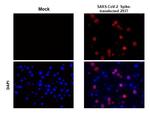 SARS/SARS-CoV-2 Spike Protein S2 Antibody in Immunohistochemistry (Paraffin) (IHC (P))