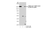 SARS/SARS-CoV-2 Spike Protein S2 Antibody in Immunoprecipitation (IP)