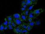 GDF3 Antibody in Immunocytochemistry (ICC/IF)