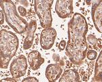 DFNA5 Antibody in Immunohistochemistry (Paraffin) (IHC (P))