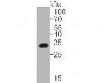 Annexin A3 Antibody in Western Blot (WB)