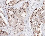 HMGB2 Antibody in Immunohistochemistry (Paraffin) (IHC (P))