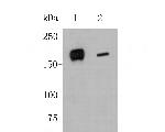 DAPK1 Antibody in Western Blot (WB)