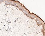 Phospho-ErbB3 (Tyr1222) Antibody in Immunohistochemistry (Paraffin) (IHC (P))