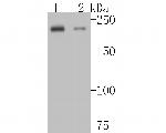 MYH7B Antibody in Western Blot (WB)