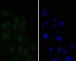 Tat-SF1 Antibody in Immunocytochemistry (ICC/IF)