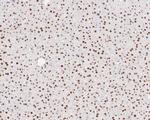 Tat-SF1 Antibody in Immunohistochemistry (Paraffin) (IHC (P))