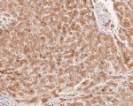 ARG2 Antibody in Immunohistochemistry (Paraffin) (IHC (P))