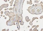 IRS1 Antibody in Immunohistochemistry (Paraffin) (IHC (P))