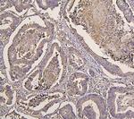 IRS1 Antibody in Immunohistochemistry (Paraffin) (IHC (P))