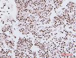 NRF1 Antibody in Immunohistochemistry (Paraffin) (IHC (P))