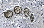 GAA Antibody in Immunohistochemistry (Paraffin) (IHC (P))