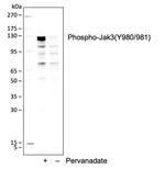 Phospho-Jak3 (Tyr980, Tyr981) Antibody in Western Blot (WB)