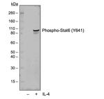 Phospho-Stat6 (Tyr641) Antibody in Western Blot (WB)