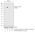 Phospho-Stat6 (Tyr641) Antibody