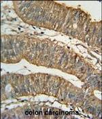 ALDH1A1 Antibody in Immunohistochemistry (Paraffin) (IHC (P))