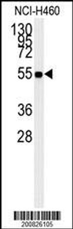 ALDH1A1 Antibody in Western Blot (WB)