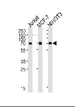 RPS6KB2 Antibody in Western Blot (WB)