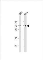 AMPK alpha-2 Antibody in Western Blot (WB)