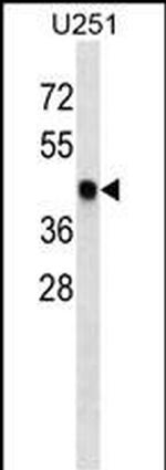 SNX6 Antibody in Western Blot (WB)