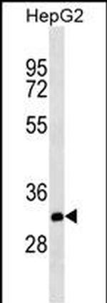 THAP11 Antibody in Western Blot (WB)