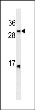 LTB Antibody in Western Blot (WB)