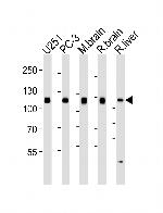 USP5 Antibody in Western Blot (WB)