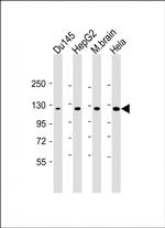 DAB2IP Antibody in Western Blot (WB)