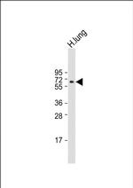 RYK Antibody in Western Blot (WB)