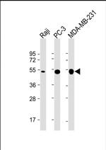 MMP1 Antibody in Western Blot (WB)