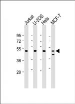 PSMC2 Antibody in Western Blot (WB)