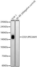CD31 (PECAM-1) Recombinant Rabbit Monoclonal Antibody (7O7K3)