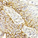 CD29 (Integrin beta 1) Antibody in Immunohistochemistry (Paraffin) (IHC (P))